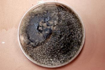 Fig. 3. Botryosphaeria isolates fruiting in the media with pycnidia. Note the dark color of the culture. Photo: A J Downer.